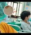 美国308准分子激光和国产的308有什么区别哪个好